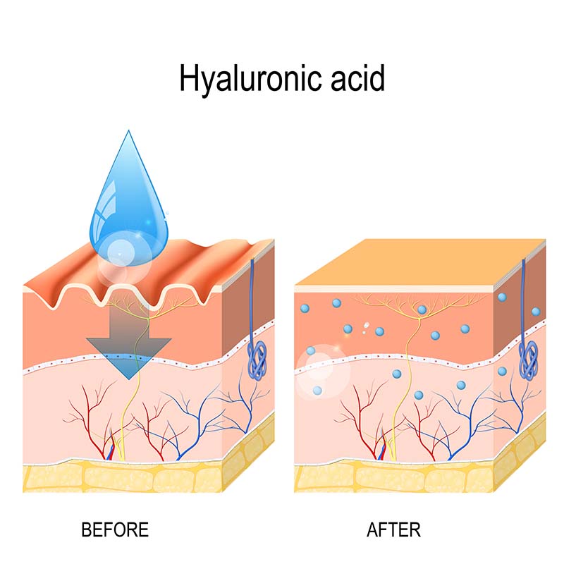 Axit Hyaluronic là gì? Chống lão hóa đúng cách với Axit Hyaluronic