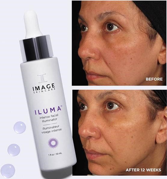 Serum trị nám trắng da Image ILUMA Intense Facial Illuminator giá bao nhiêu? Mua ở đâu tốt nhất?